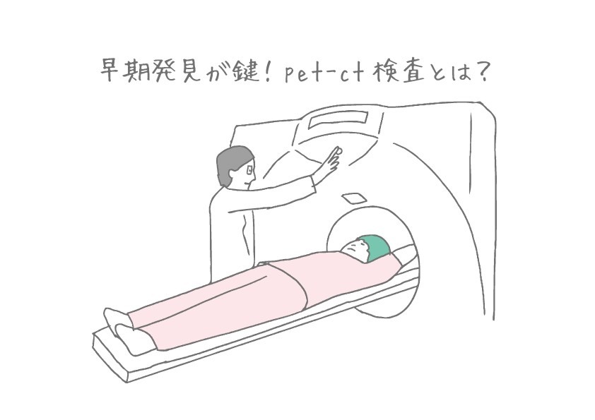 早期発見が鍵！pet-ct検査とは？